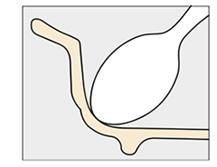 すくいやすい形状